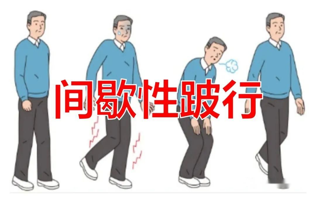 腰椎滑脱的病因,腰椎滑脱症最常见的鉴别诊断