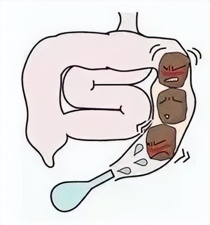 宝宝排便困难大哭大便成形,宝宝排便困难很用力也排不出