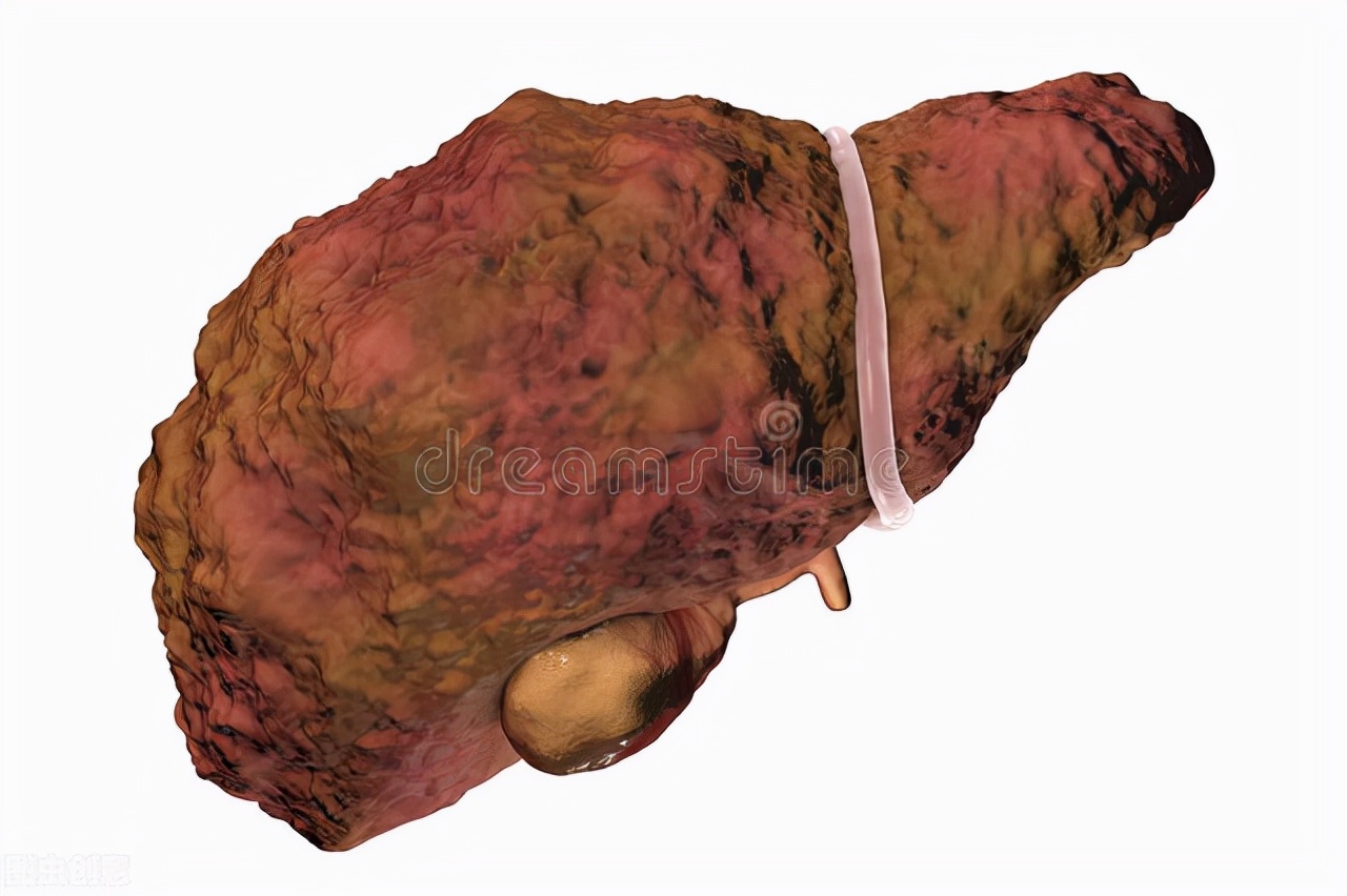 “体香”秒变“体臭”！身体发出这样的异味要警惕大病来袭