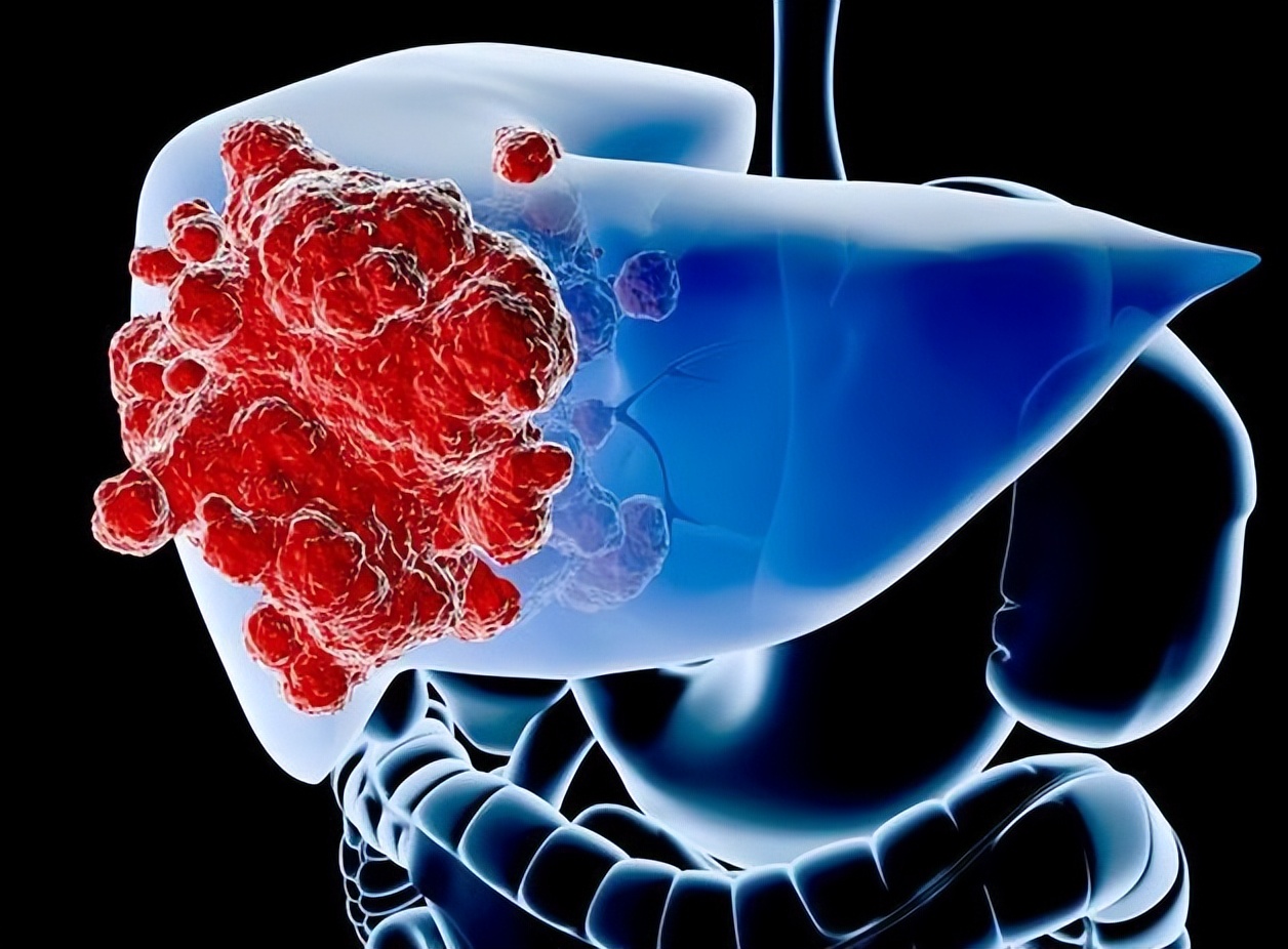 肝脏肿瘤一般长到5cm要几年,肝脏肿瘤几公分会有症状