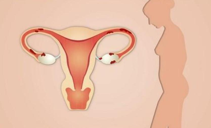 没有子宫的女人，和正常女性有什么不同？2个变化，可能无法改变