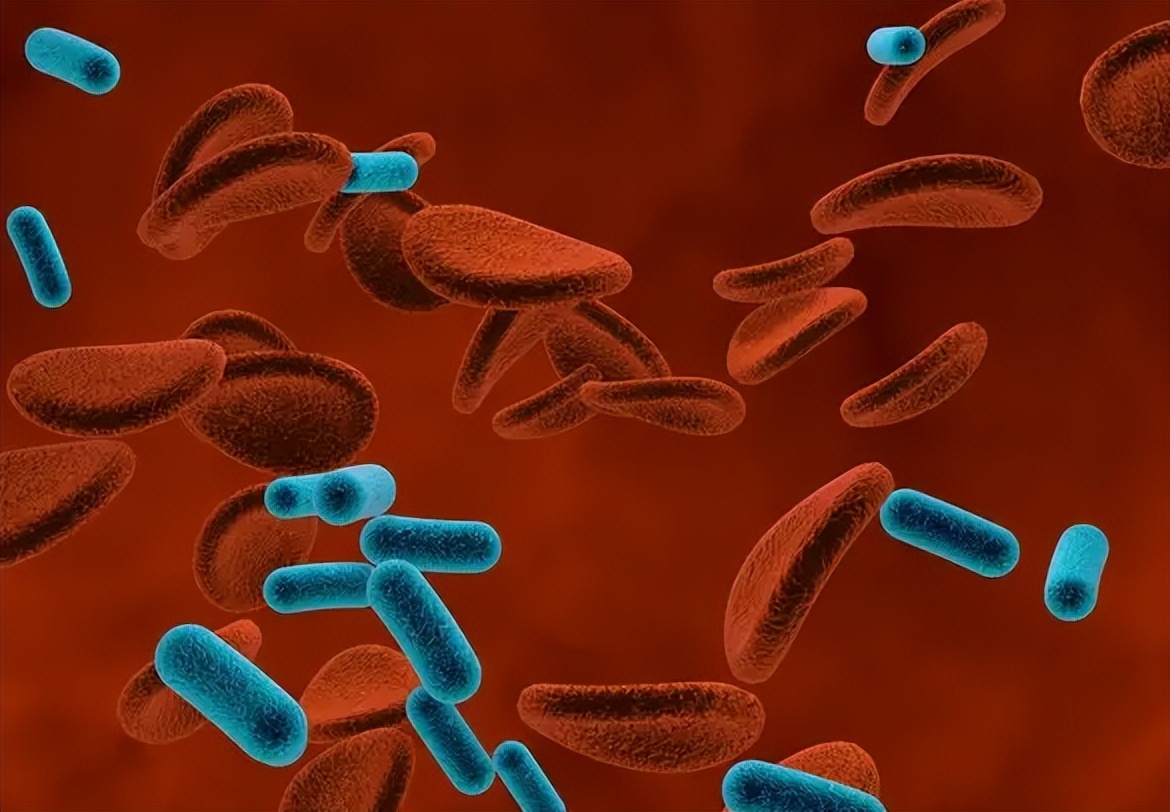 菌血症怎么治才能除根,菌血症最新治疗方法