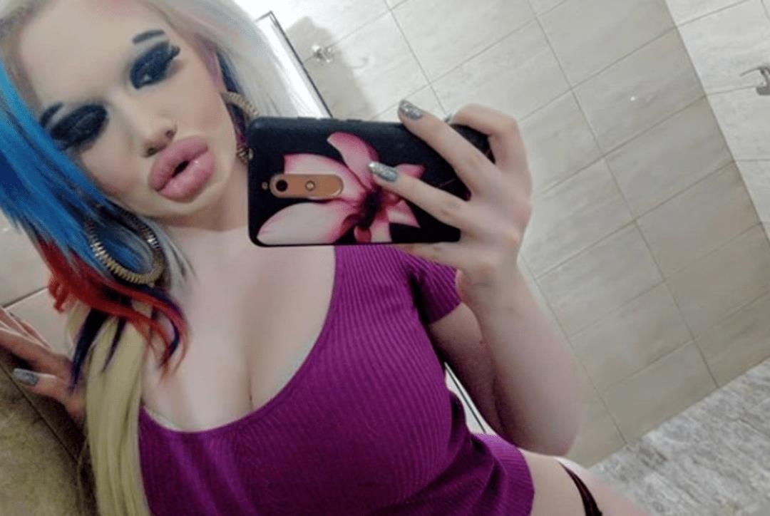 全网最厚嘴唇女网红,整容很多次网红厚嘴唇