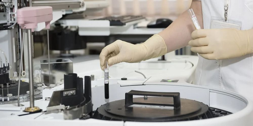 专利信息技术深度分析,专利数据统计分析