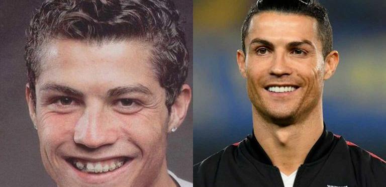 c罗内马尔厄齐尔,c罗内马尔贝尔照片