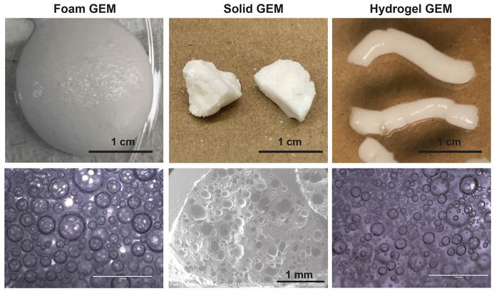 拉肚子肠道有炎症用什么偏方,肠道炎症拉肚子怎么缓解