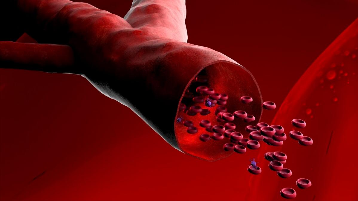 北京血管外科刁永鹏在哪坐诊,北京医院刁永鹏主任