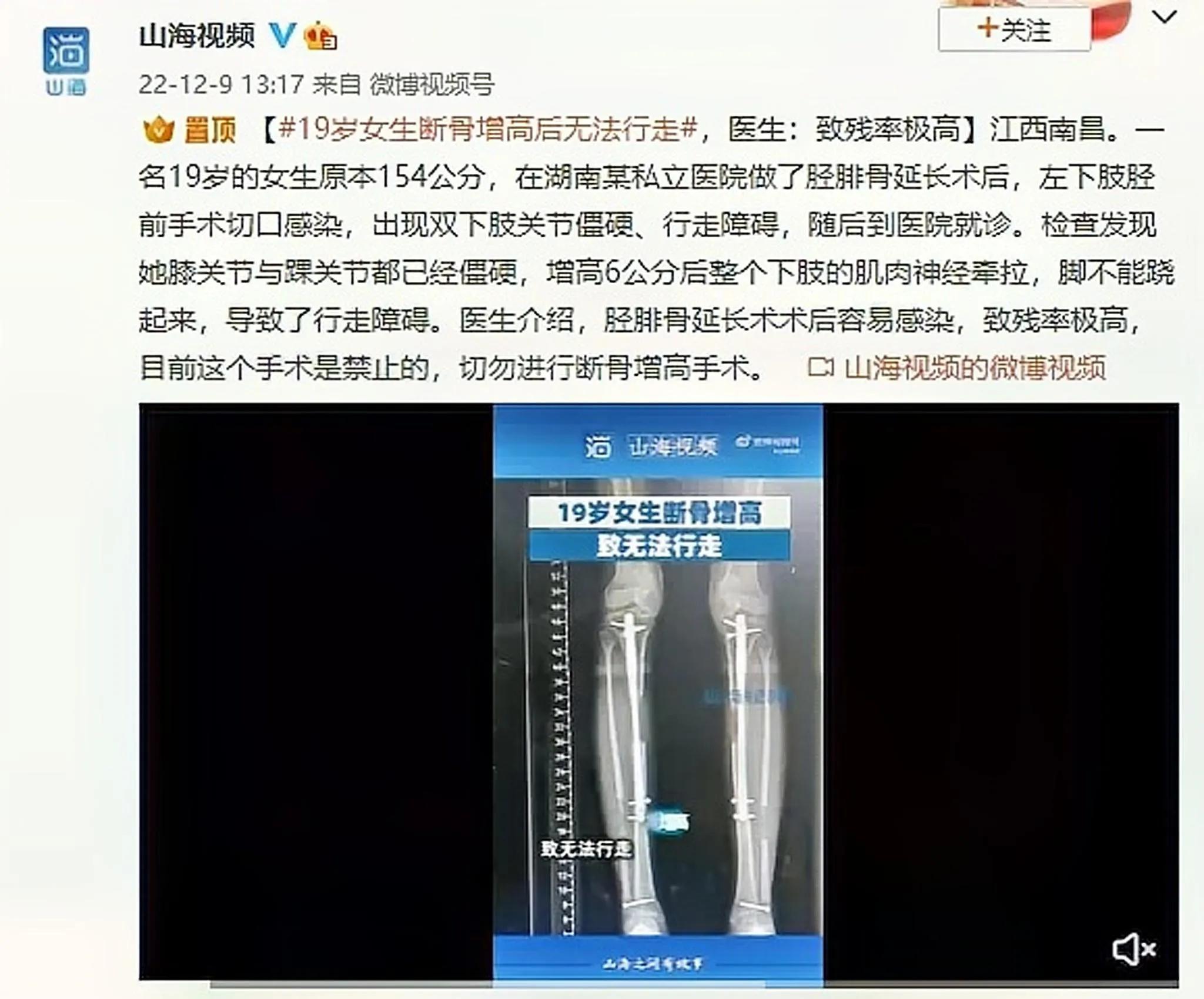24岁前如何科学有效率的长高,科学快速长高的方法14岁以下