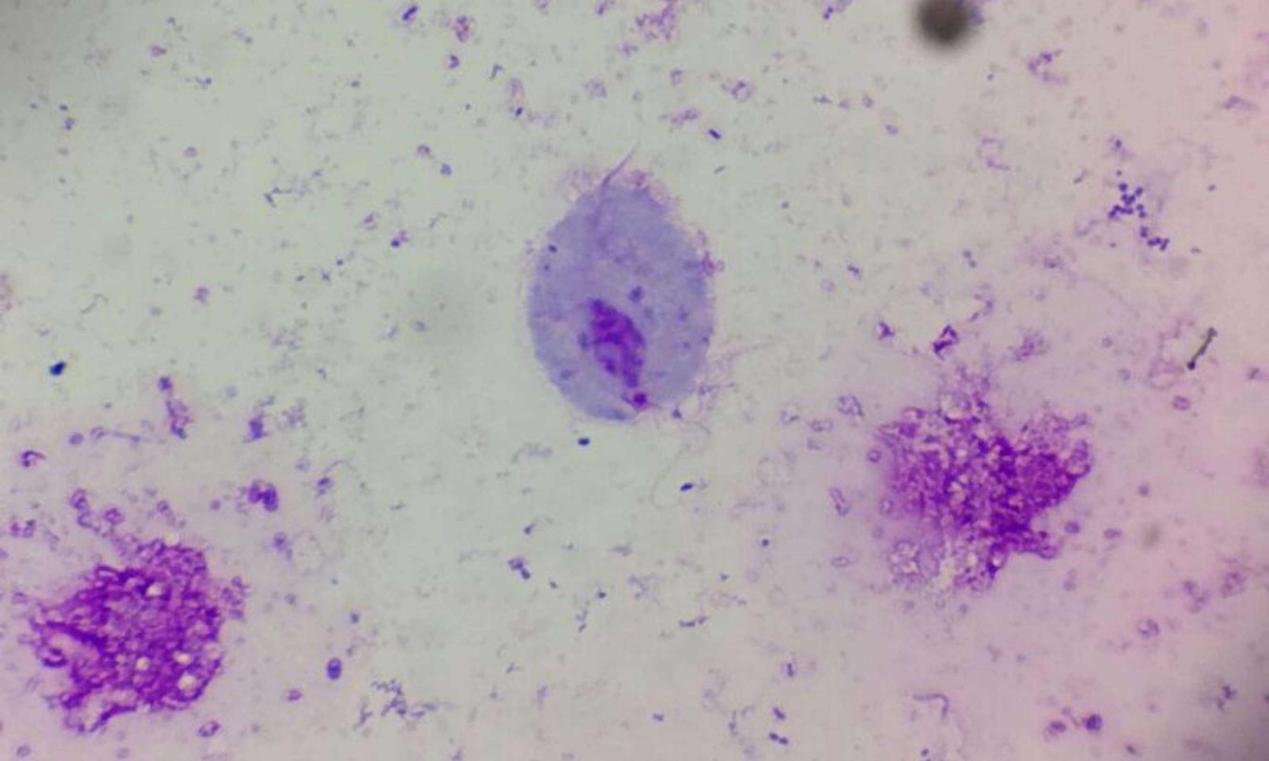 内衣裤穿一天到底有多脏,穿一天的裤子后边有异味