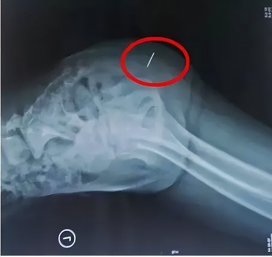 2岁女孩下身红肿，一碰就疼，扒开裤子后，医生都心疼坏了