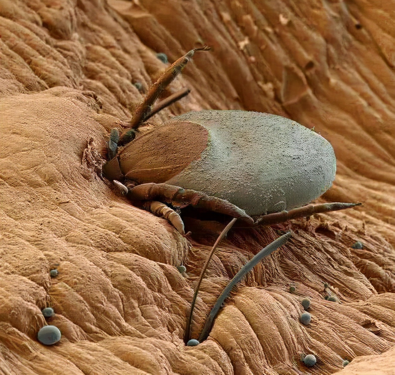 被子长期不晒“螨虫”扎堆？教你一招，不用晒不用洗，除螨又卫生