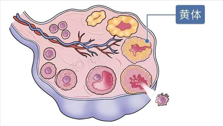 同房后酿成的悲剧：黄体破裂，夫妻生活不是打仗，要适度而行！