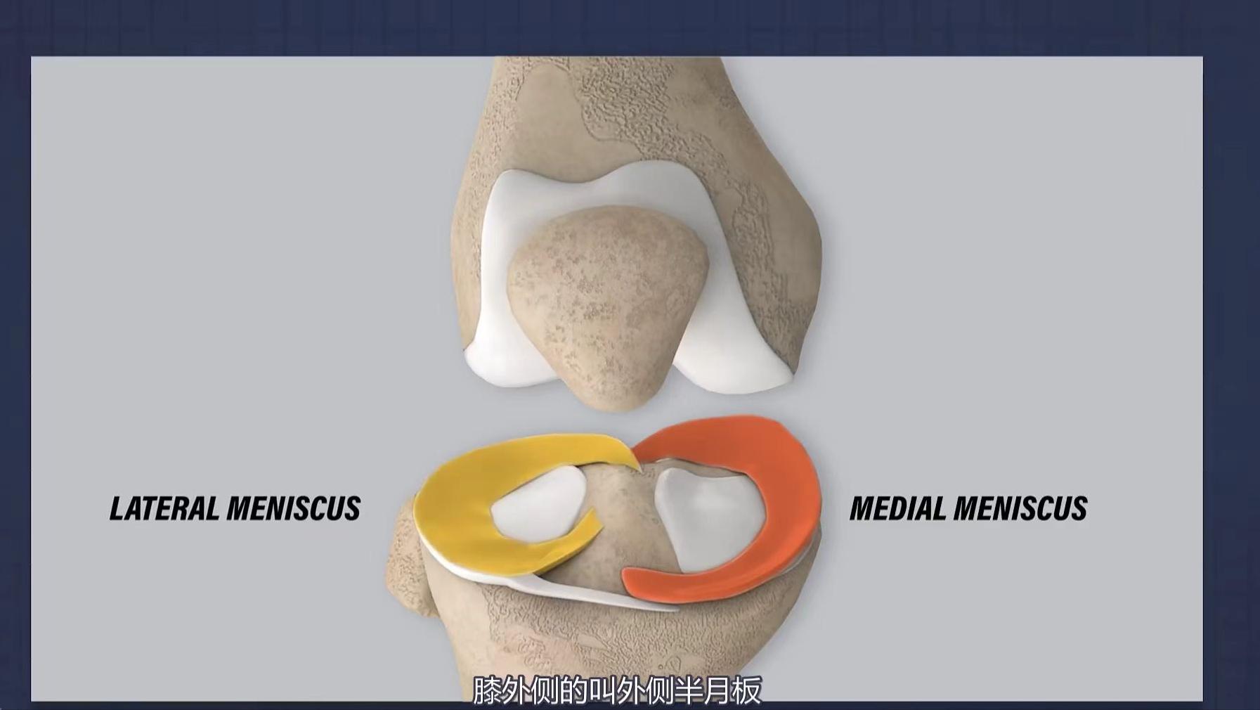 半月板损伤的康复训练6个方法,半月板损伤怎么进行锻炼康复
