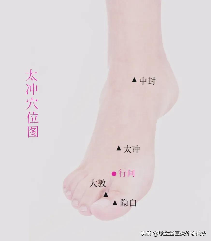 肝火上炎，五穴一方来解决