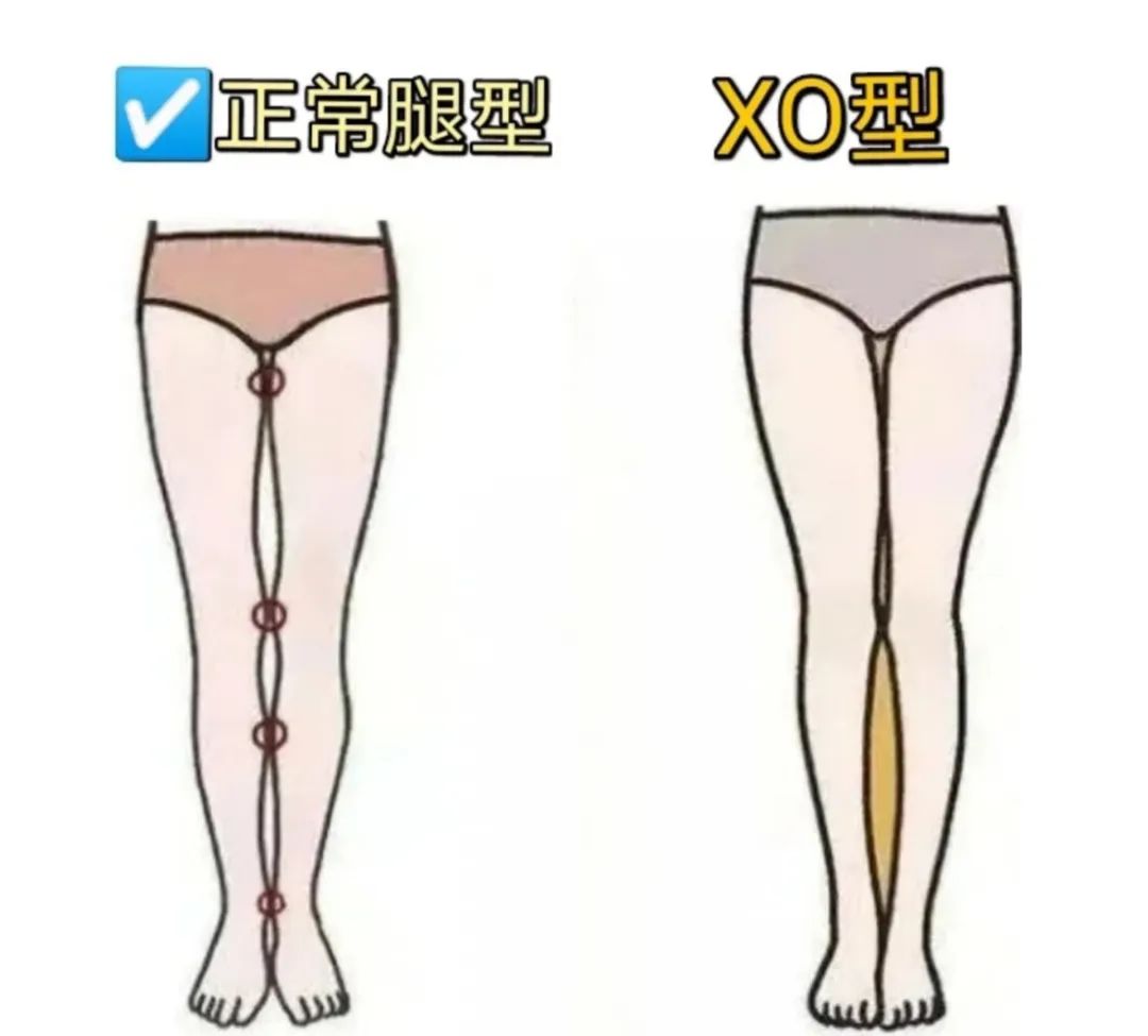 为什么男生的腿都要比女生细,为什么男生都喜欢腿细的女生
