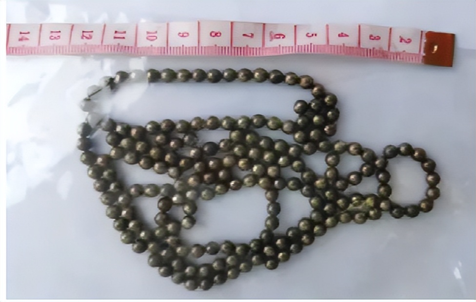 浙江14岁男孩体内取出19颗磁力珠,十一岁男孩吞磁珠