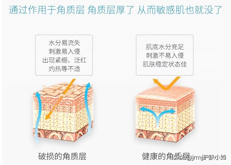 敏感肌既能省钱又能变美的妙招,干痒脱皮刺痛泛红如何拯救敏感肌