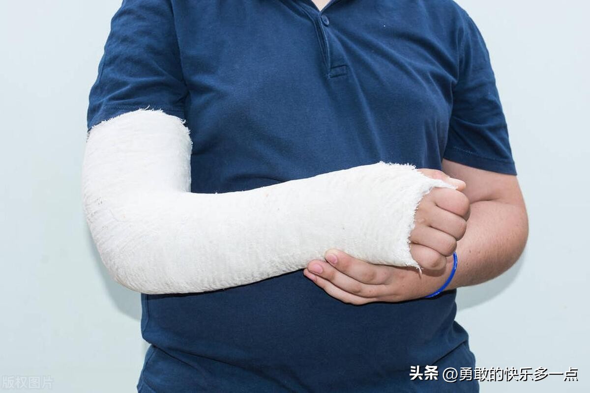 肱骨髁上骨折,肱骨髁上骨折图