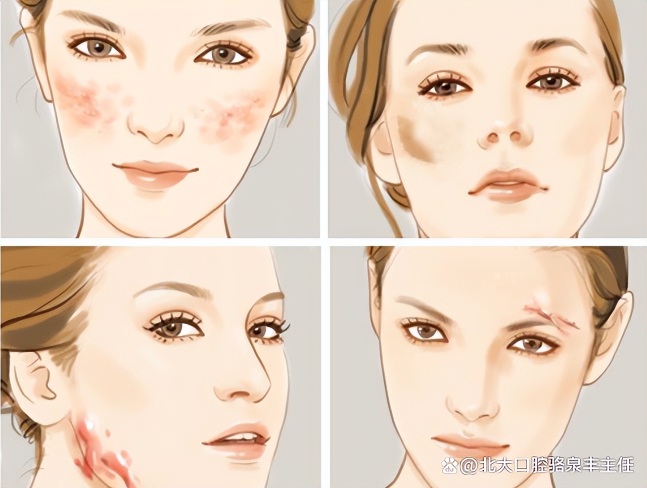 疤痕增生发痒不舒服，多是因为这3种情况，教你应对的方法