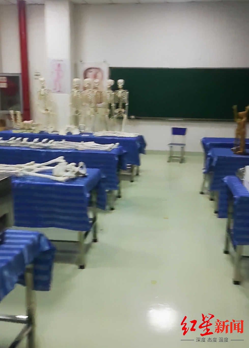 女孩针灸几针后死亡,13岁女孩针灸数针后死亡