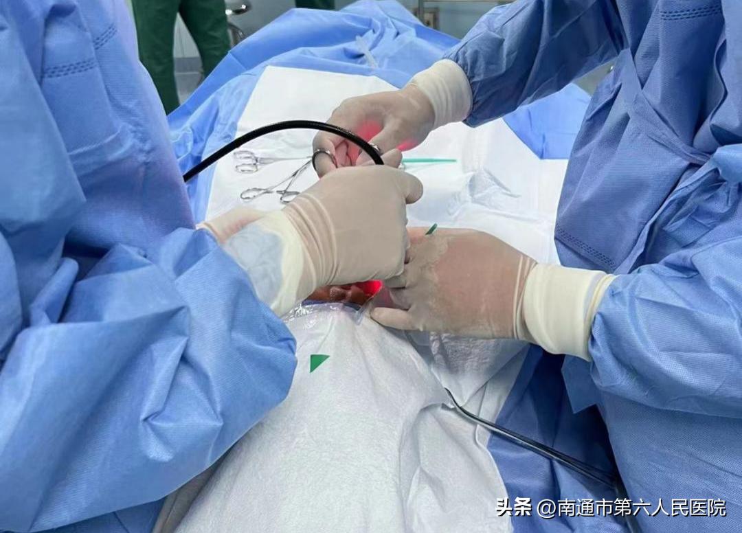 口、颜面部肿瘤，“一束光”带来了新希望