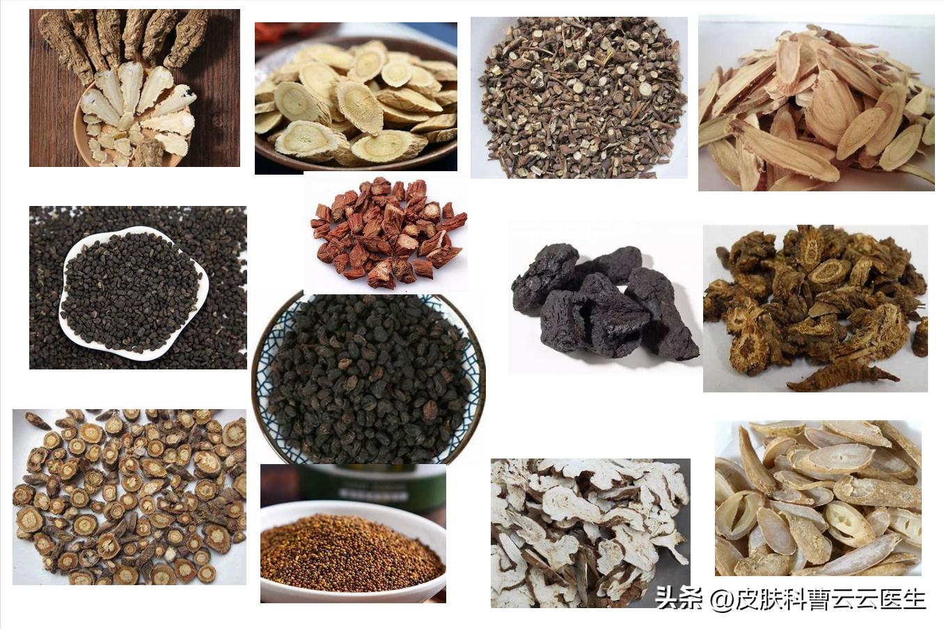 中药治疗银屑病用什么药,张仲景中药治疗银屑病方子