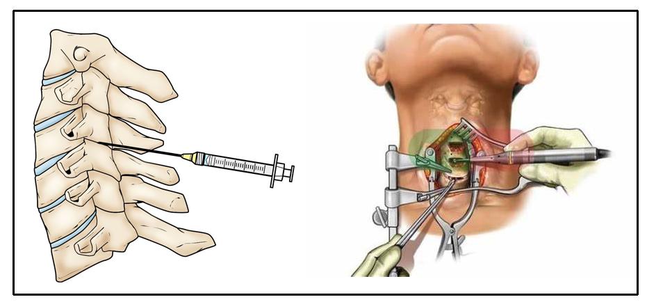 颈痛的最佳治疗方法,最近肩颈疼是什么病毒
