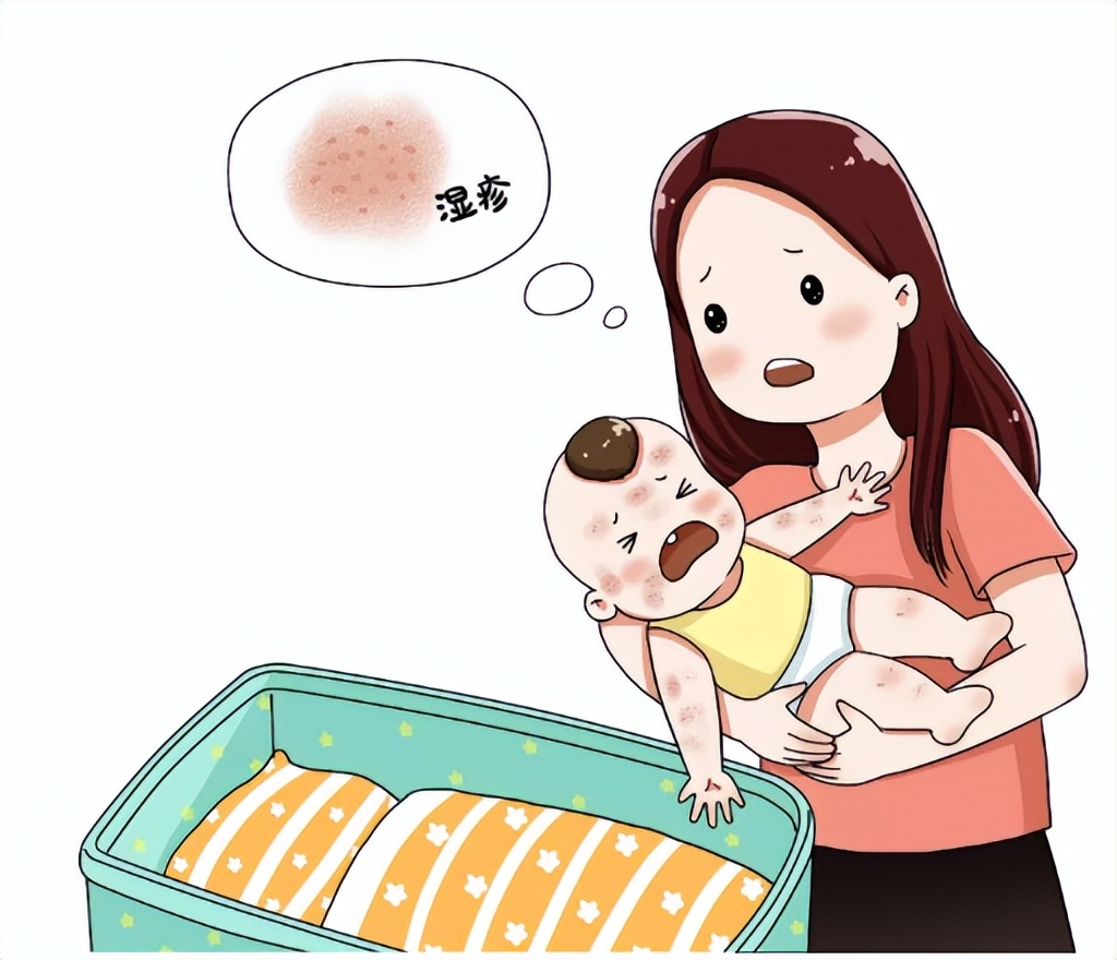 季节性神经性湿疹,季节性皮炎和湿疹