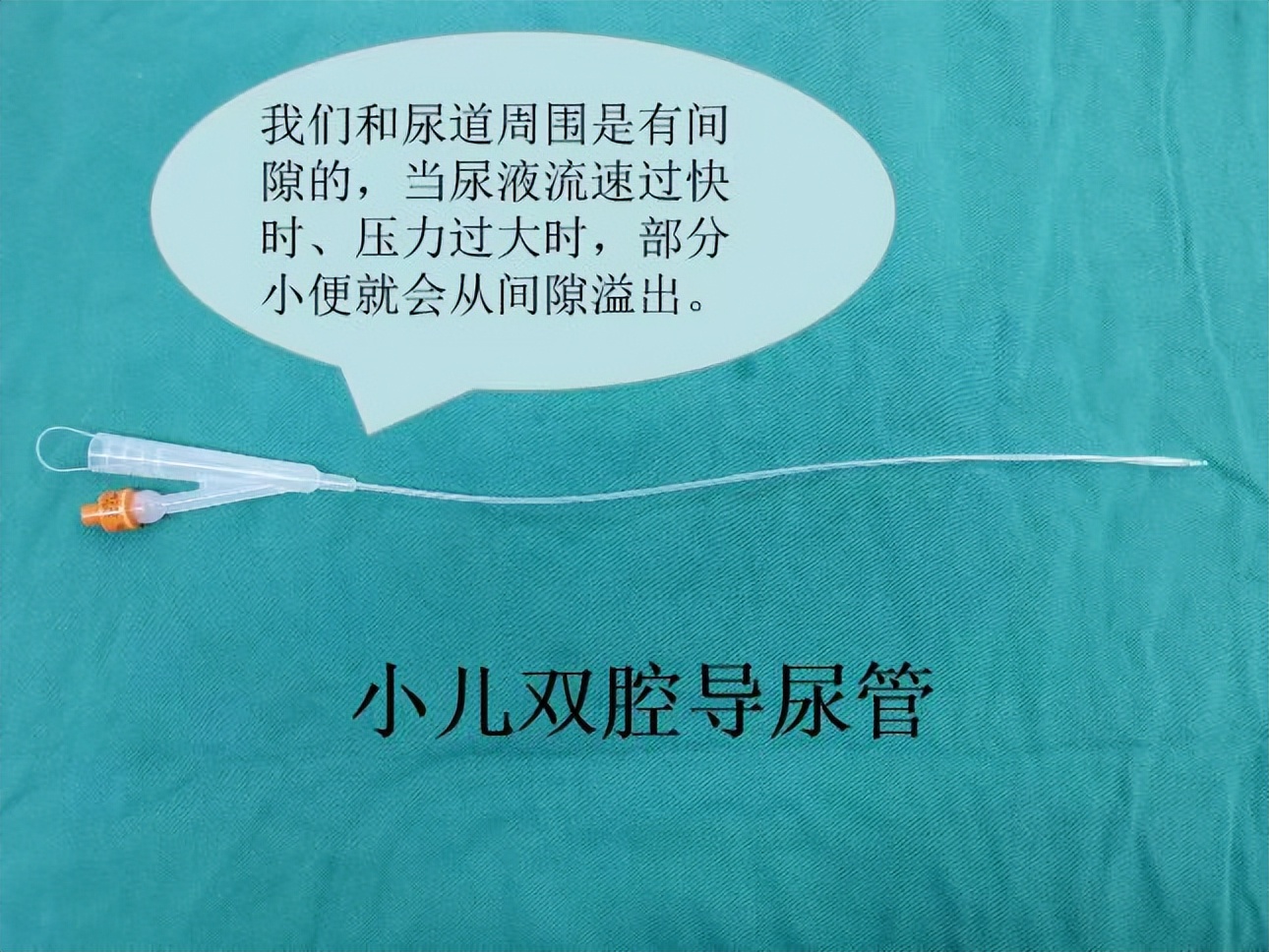 尿道下裂术后护理有哪些注意事项？（家长篇）