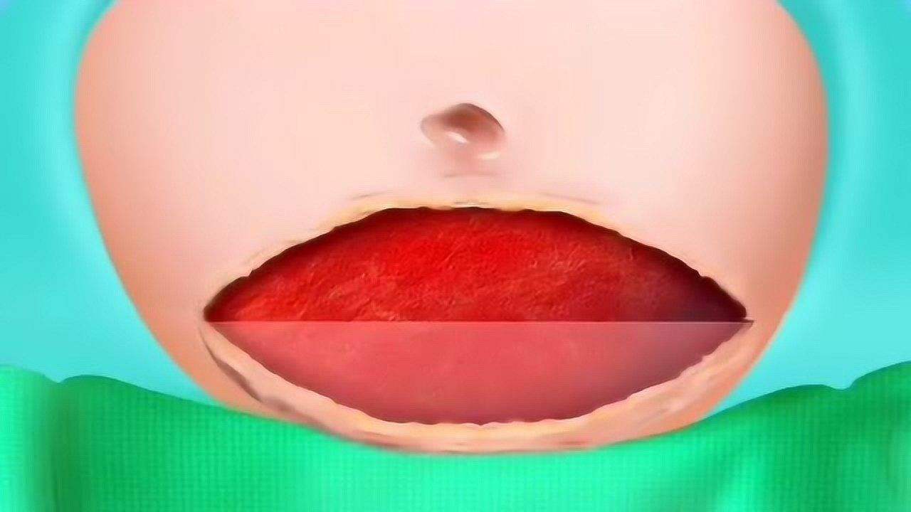 顺产VS剖宫产到底哪个好？终于有医生讲明白了，看完请多爱护女性