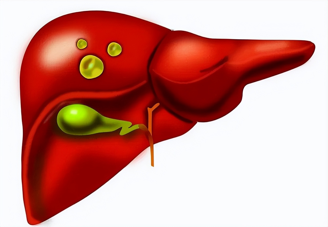 医生说有个囊肿是怎么回事,医生说囊肿是良性的但是需要手术