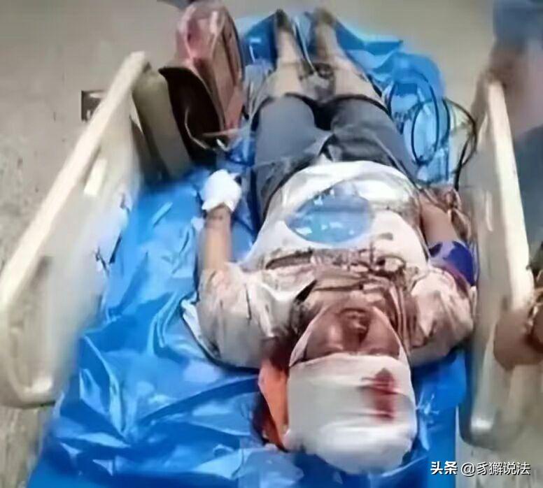 轻伤二级的量刑标准,轻伤二级不谅解案例