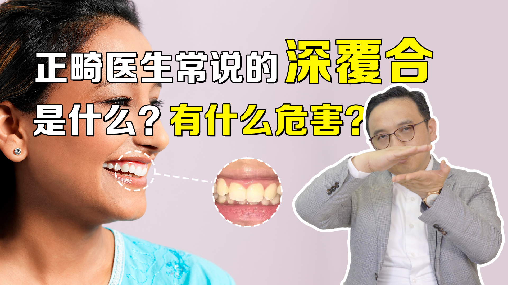 成人深覆合有必要矫正吗,深覆合矫正到一半后悔了