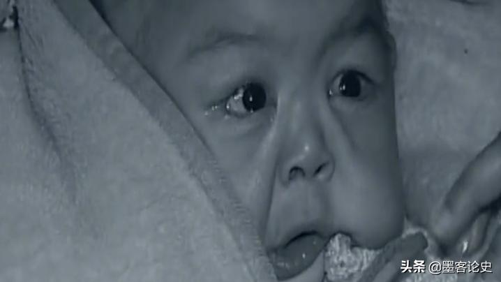 故事:河南1岁女婴患早老症,一夜变成80岁老人,母亲含泪千里求医