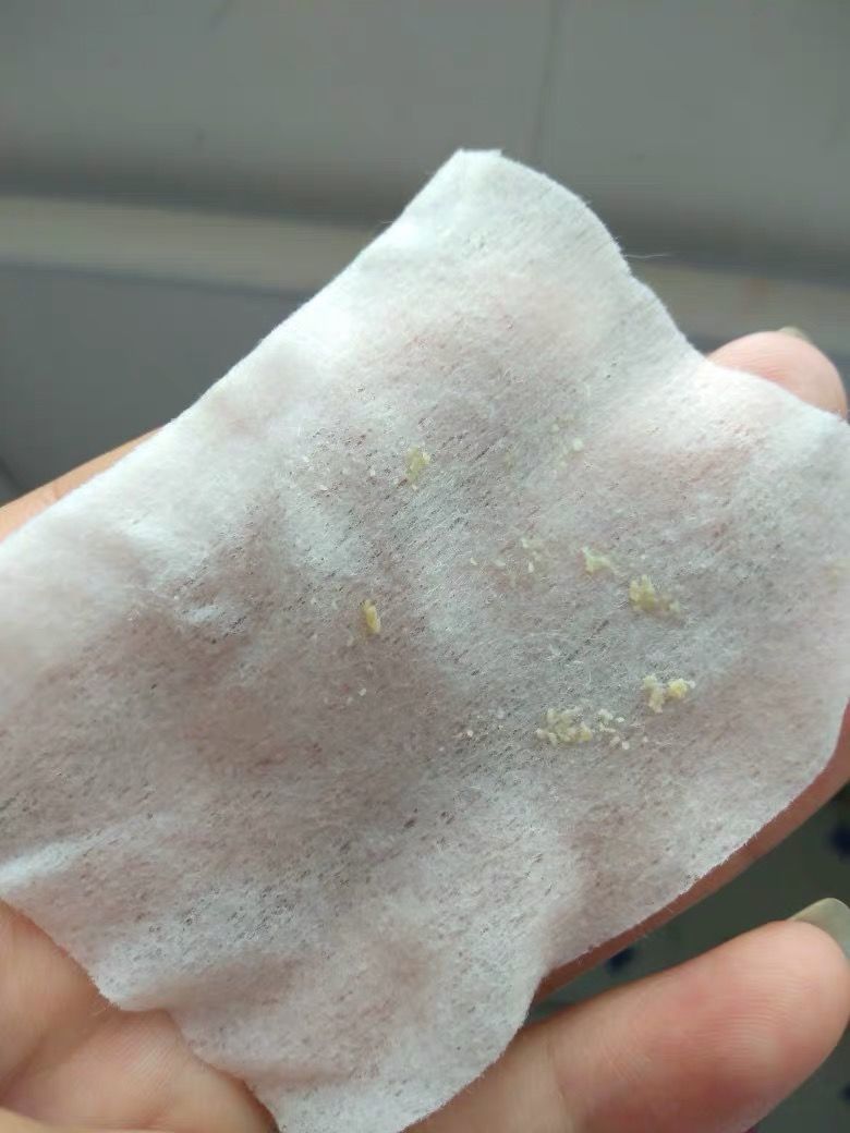 卸粉底后感觉鼻子上的毛孔有白点,为什么上完粉底液鼻子上有黑点