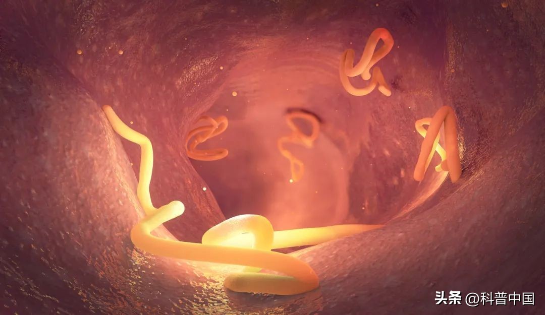 怎样除去生吃蔬菜寄生虫,这5种蔬菜别生吃小心感染寄生虫