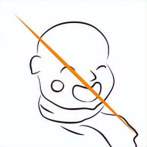 雌二醇用量用法,雌二醇激素用法