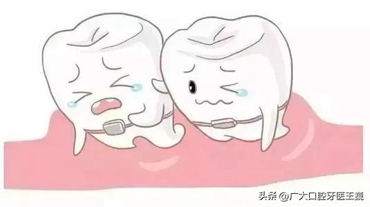 矫正牙齿戴牙套感觉疼痛怎么缓解,牙齿矫正戴牙套牙疼怎么解决