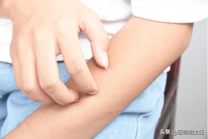 湿疹和荨麻疹汗疱疹同时出现吗,汗疱疹后期干裂瘙痒用什么药