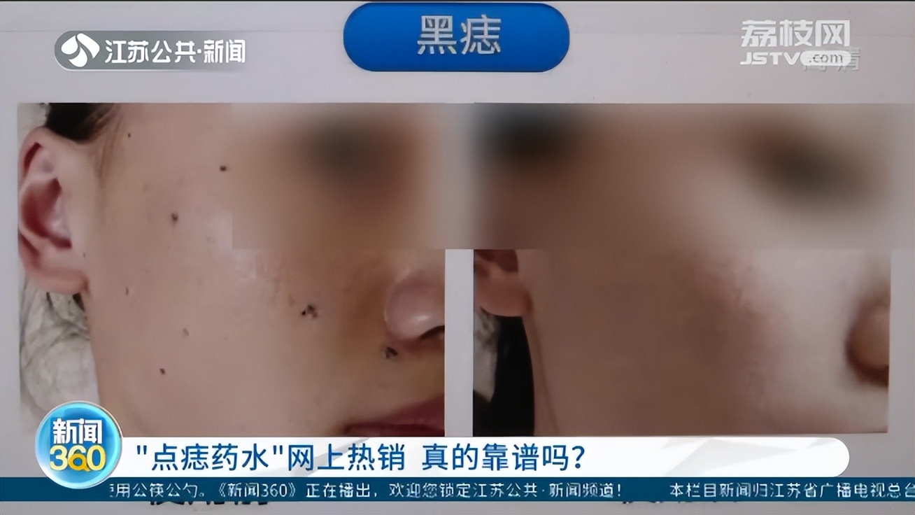 红药水和紫药水的区别致癌,抗癌红色的药水