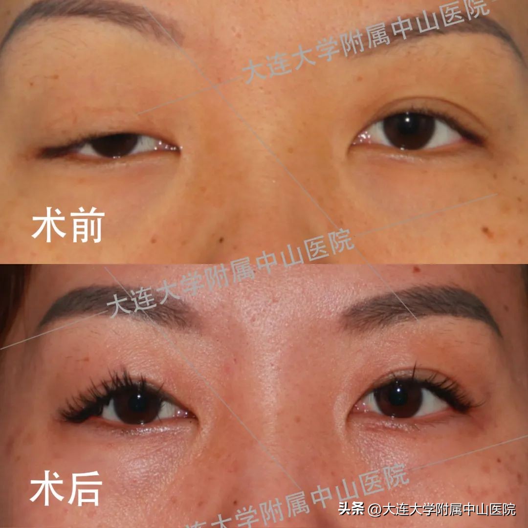 中山慈善万人行启动仪式,中山慈善现场直播