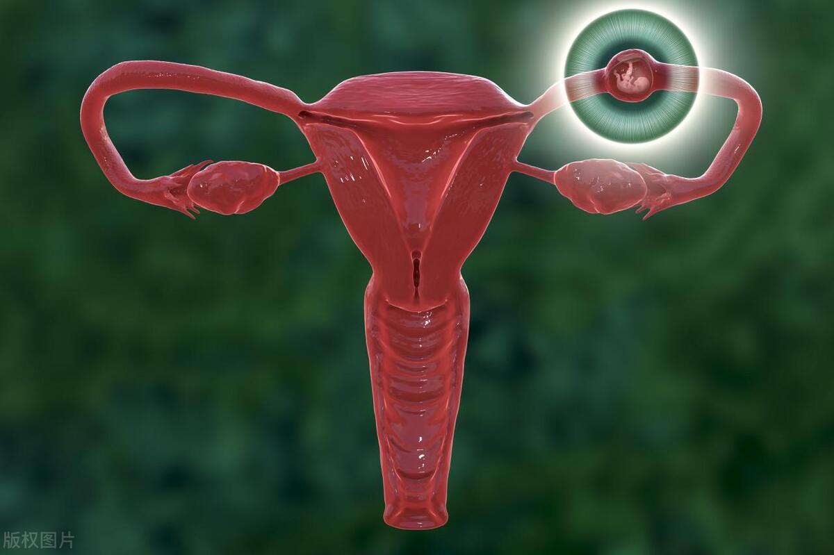 流产后有异味买什么药,流产一个月有腥臭味