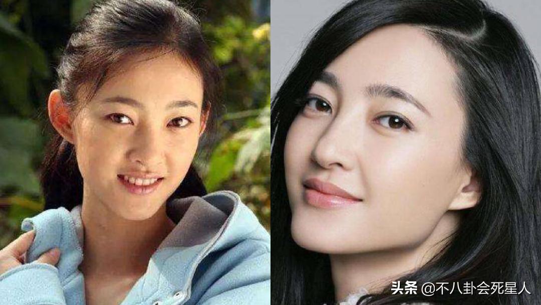 景甜悲伤蛙双眼皮照片,明星割双眼皮前后对比图