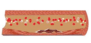 这根血管连通大脑最容易堵!很多人半身不遂后才发现!不看后悔!