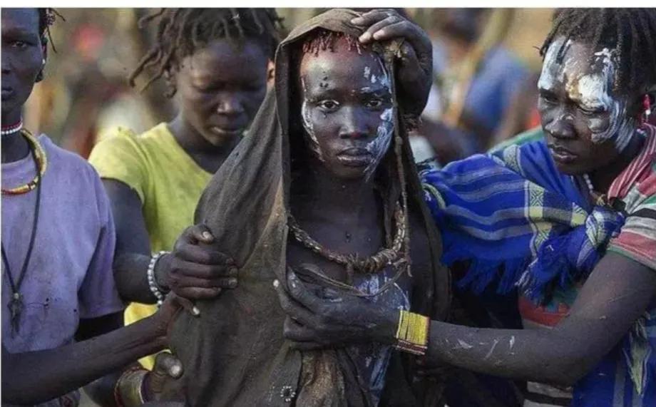 非洲阉割女孩的陋习已延续了4000年，仍旧存在着。让人谈之色变