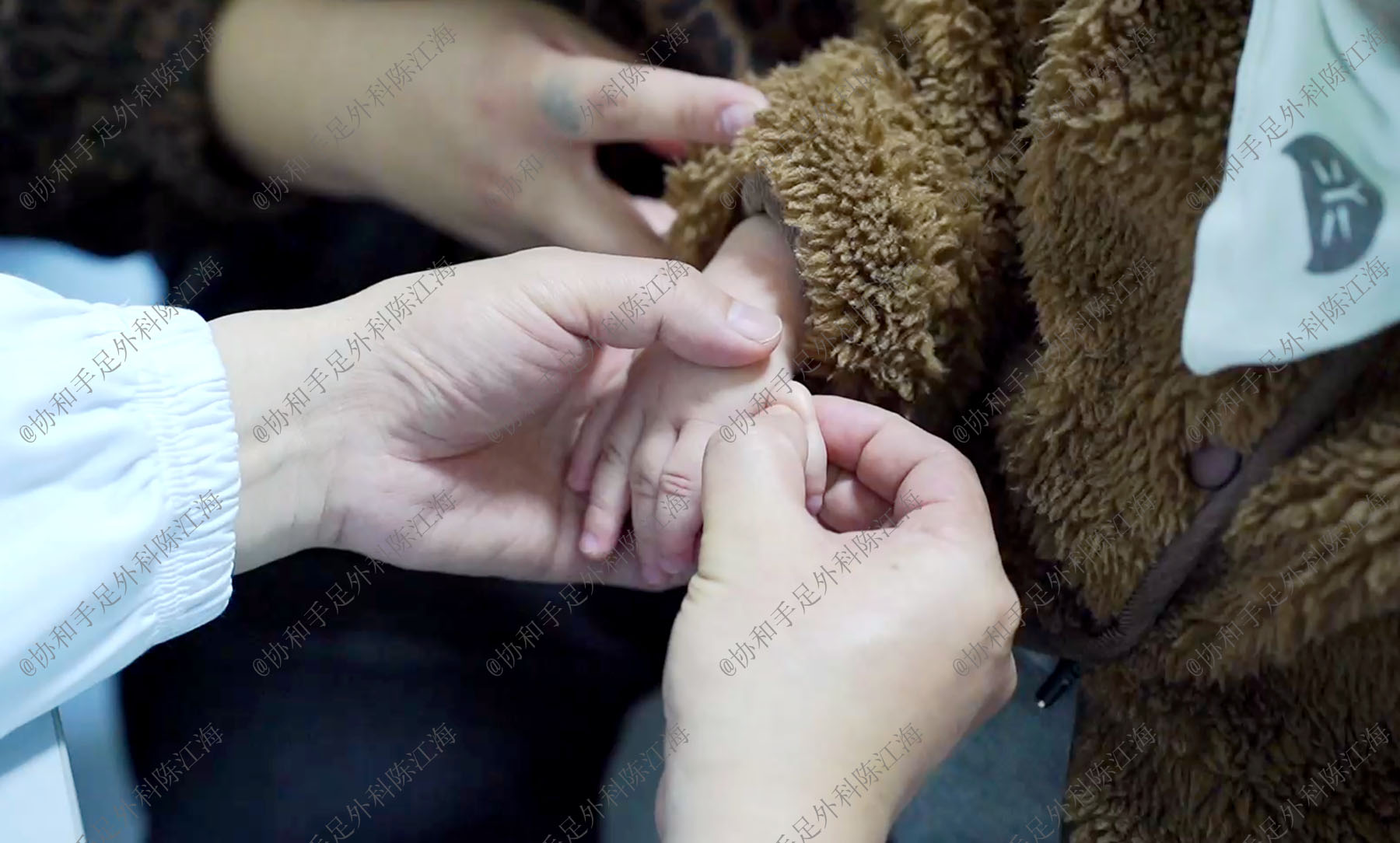 漂浮趾的治疗,拇指漂浮指的治疗方案