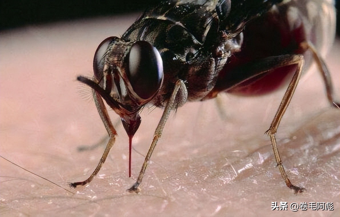 美国女子吃蜱虫被咬死,美国女子被虫子咬