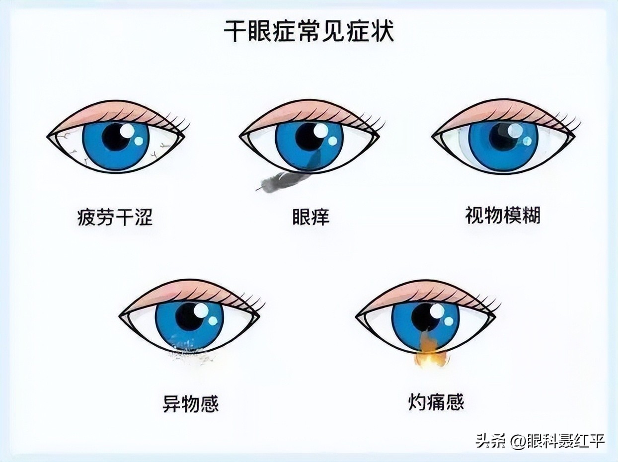 老年人干眼症的危害,激光术后干眼症危害