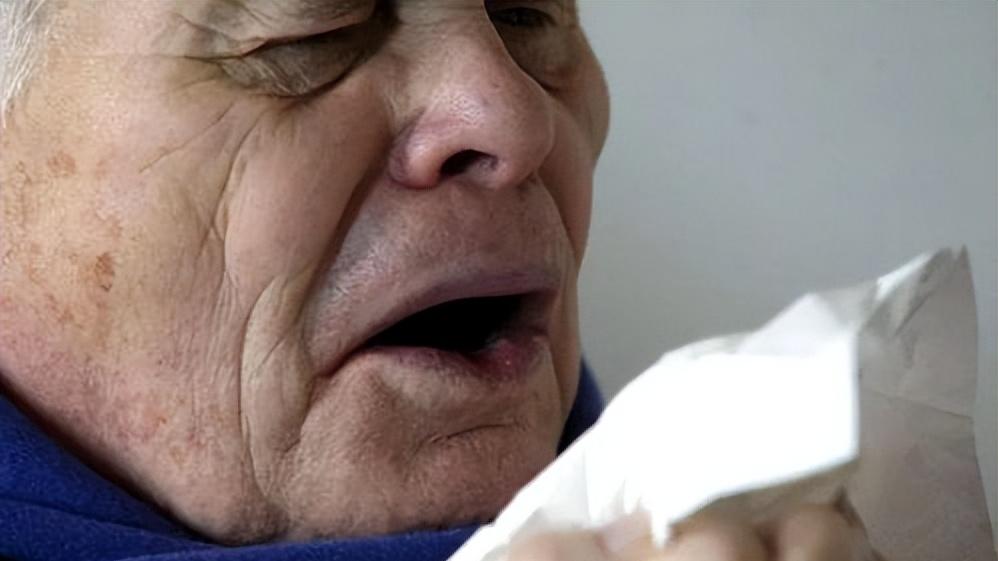 又痒又痛的皮肤病是什么病,特应性皮炎特别痒怎么办