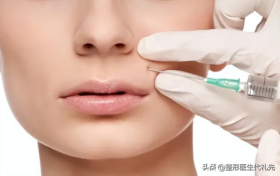 去法令纹现在最有效的方法是什么,去除法令纹的最有效的方法有哪些